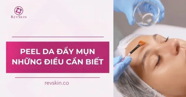 peel da đẩy mụn và những điều cần biết