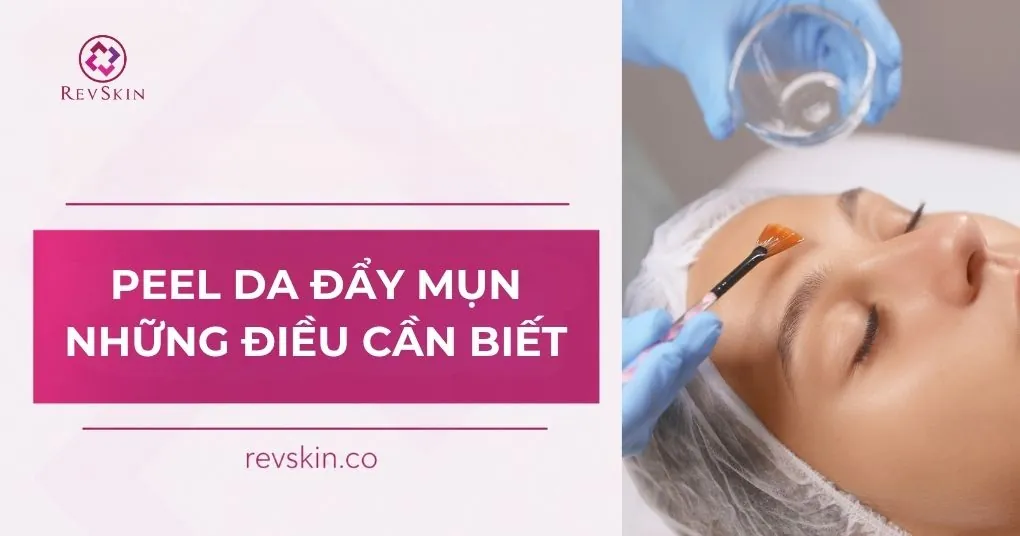 Peel da đẩy mụn và những điều cần biết peel da đẩy mụn và những điều cần biết