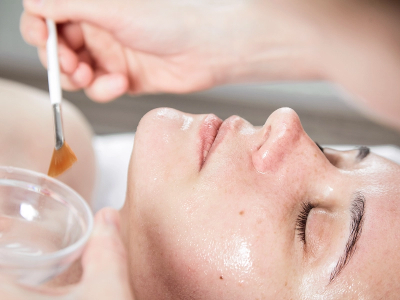 Peel da hóa học sẽ mang lại hiệu quả cao hơn trong việc cải thiện làn da
