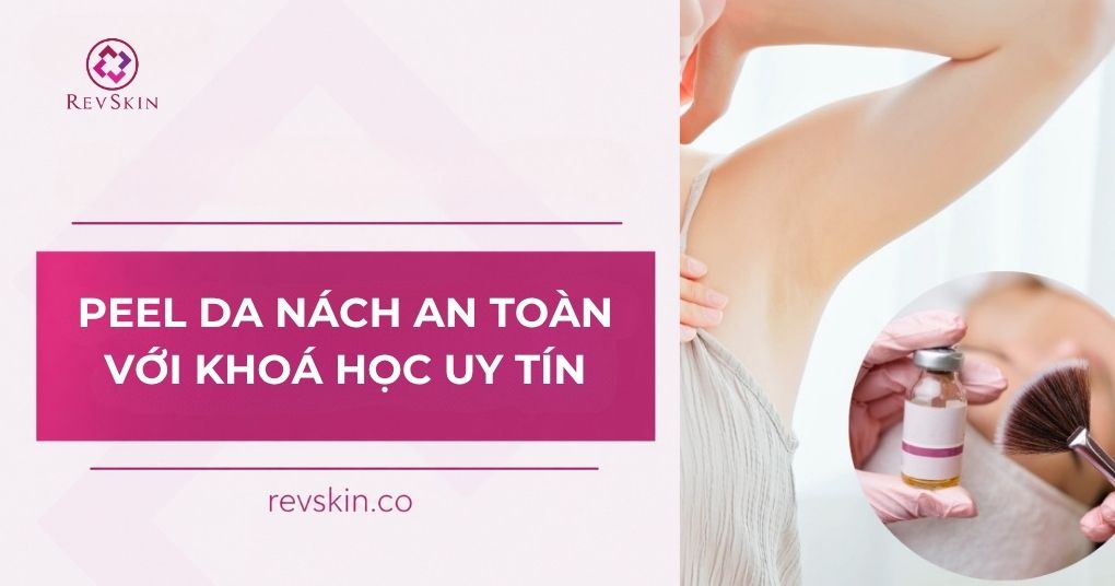 Chuyển giao công nghệ Revskin