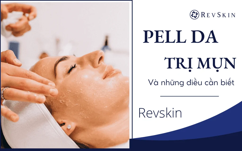 Peel da trị mụn