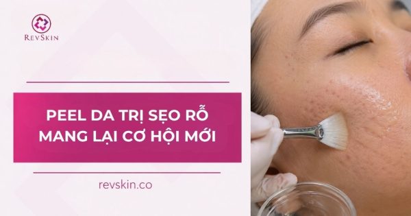 peel da trị sẹo rỗ mang lại cơ hội mới