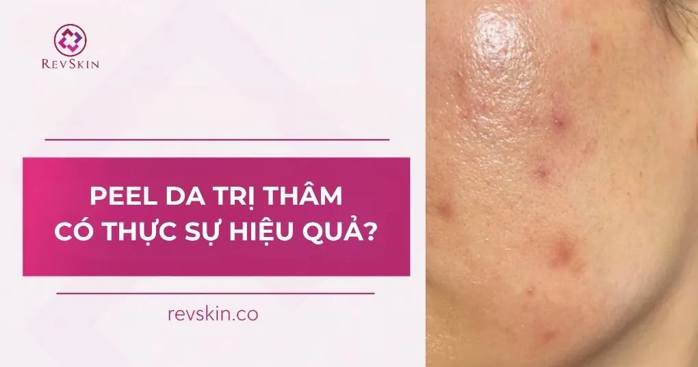 peel da trị thâm có thực sự hiệu quả