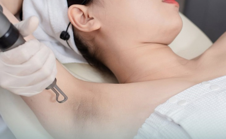CÔNG NGHỆ TRỊ THÂM NÁCH HIỆU QUẢ VÀ HIỆN ĐẠI Công nghệ trị thâm nách bằng laser mang lại hiệu quả cao