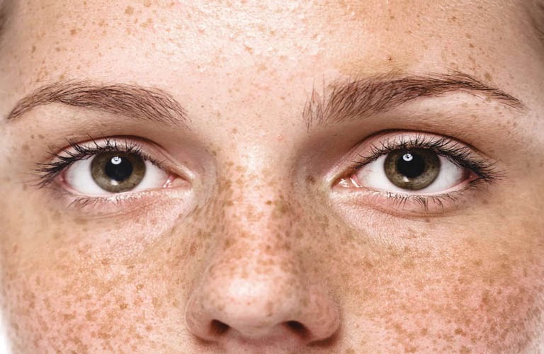Chuyển giao công nghệ Revskin