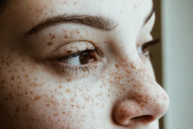 Chuyển giao công nghệ Revskin