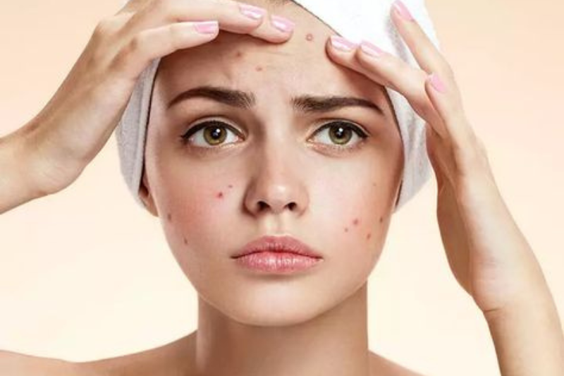 Chuyển giao công nghệ Revskin