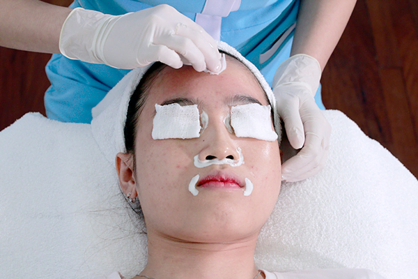 Peel mụn giúp cải thiện tình trạng và làm  giảm mụn rõ rệt
