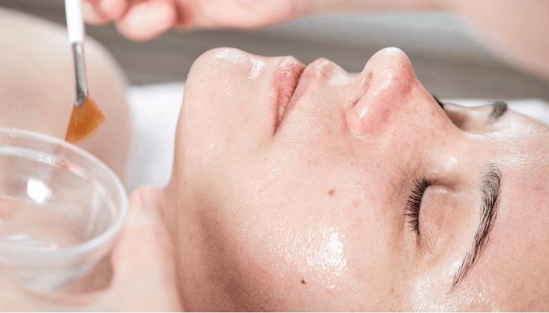 Chuyển giao công nghệ Revskin