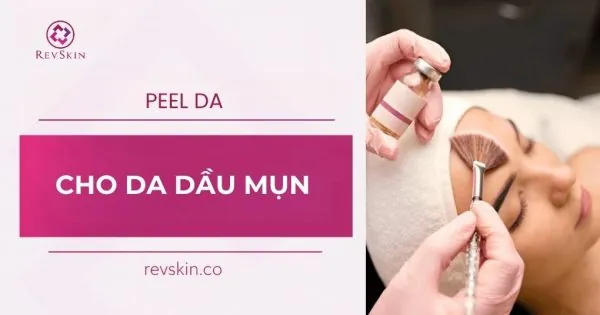 peel da cho da dầu mụn