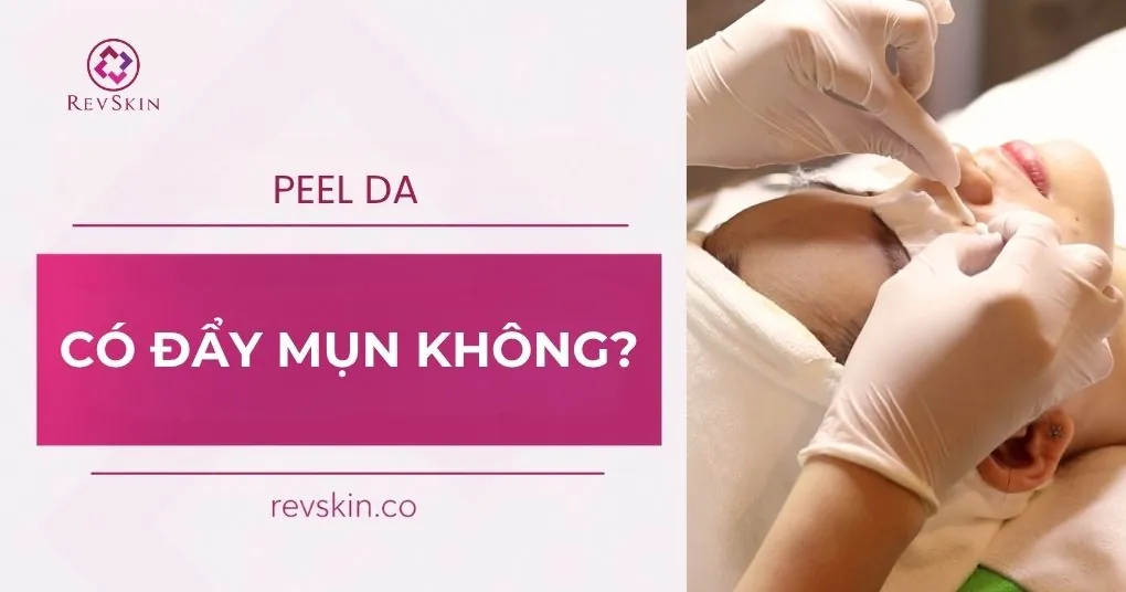 peel da có đẩy mụn không