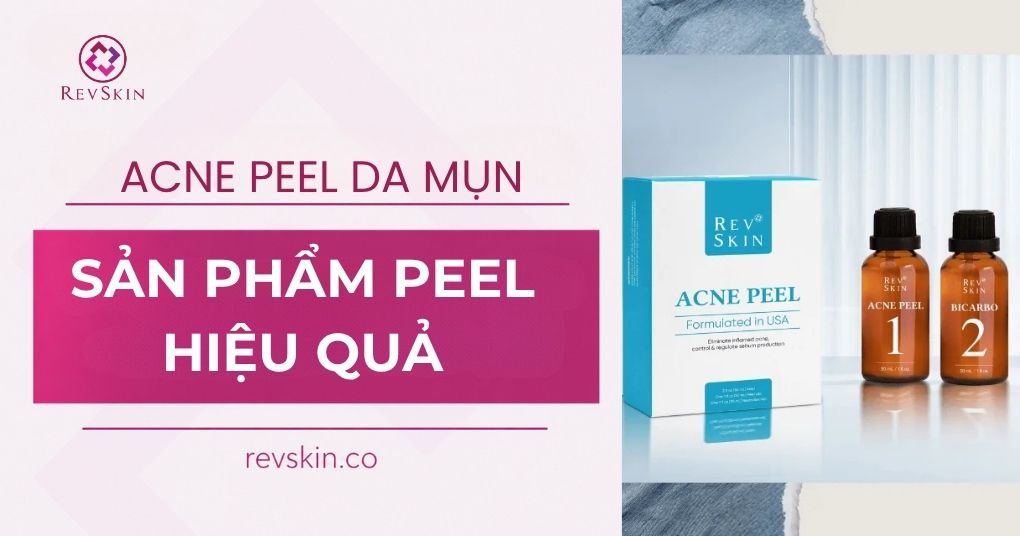 Chuyển giao công nghệ Revskin