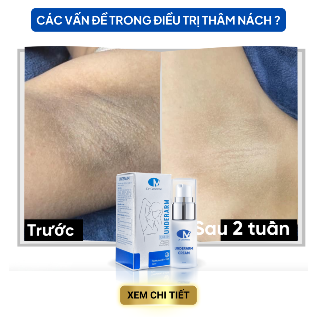 Chuyển giao công nghệ Revskin