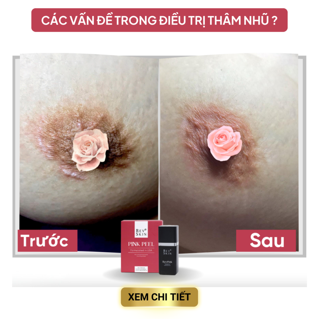 Chuyển giao công nghệ Revskin