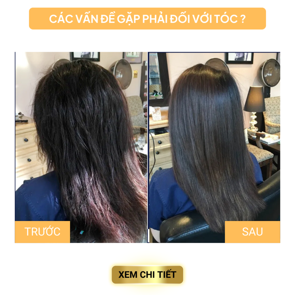 Chuyển giao công nghệ Revskin