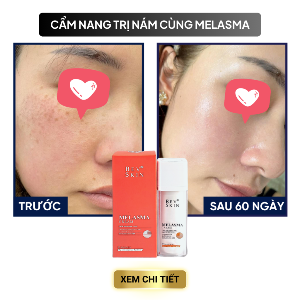 Chuyển giao công nghệ Revskin
