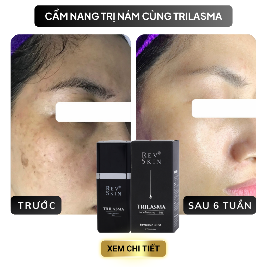Chuyển giao công nghệ Revskin
