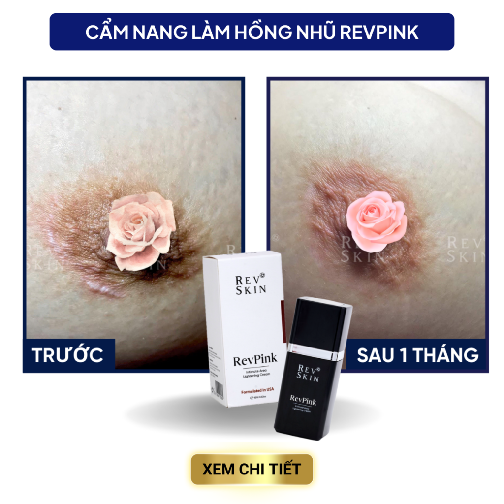 Chuyển giao công nghệ Revskin