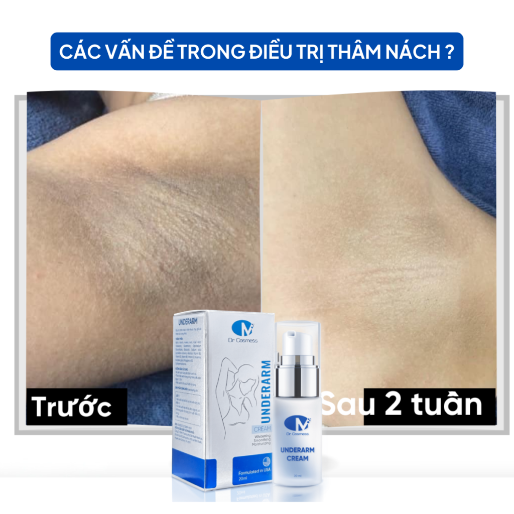 Chuyển giao công nghệ Revskin