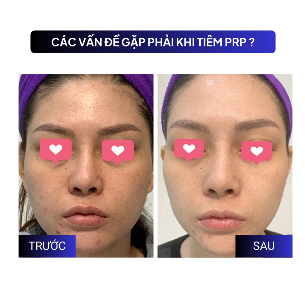 Chuyển giao công nghệ Revskin