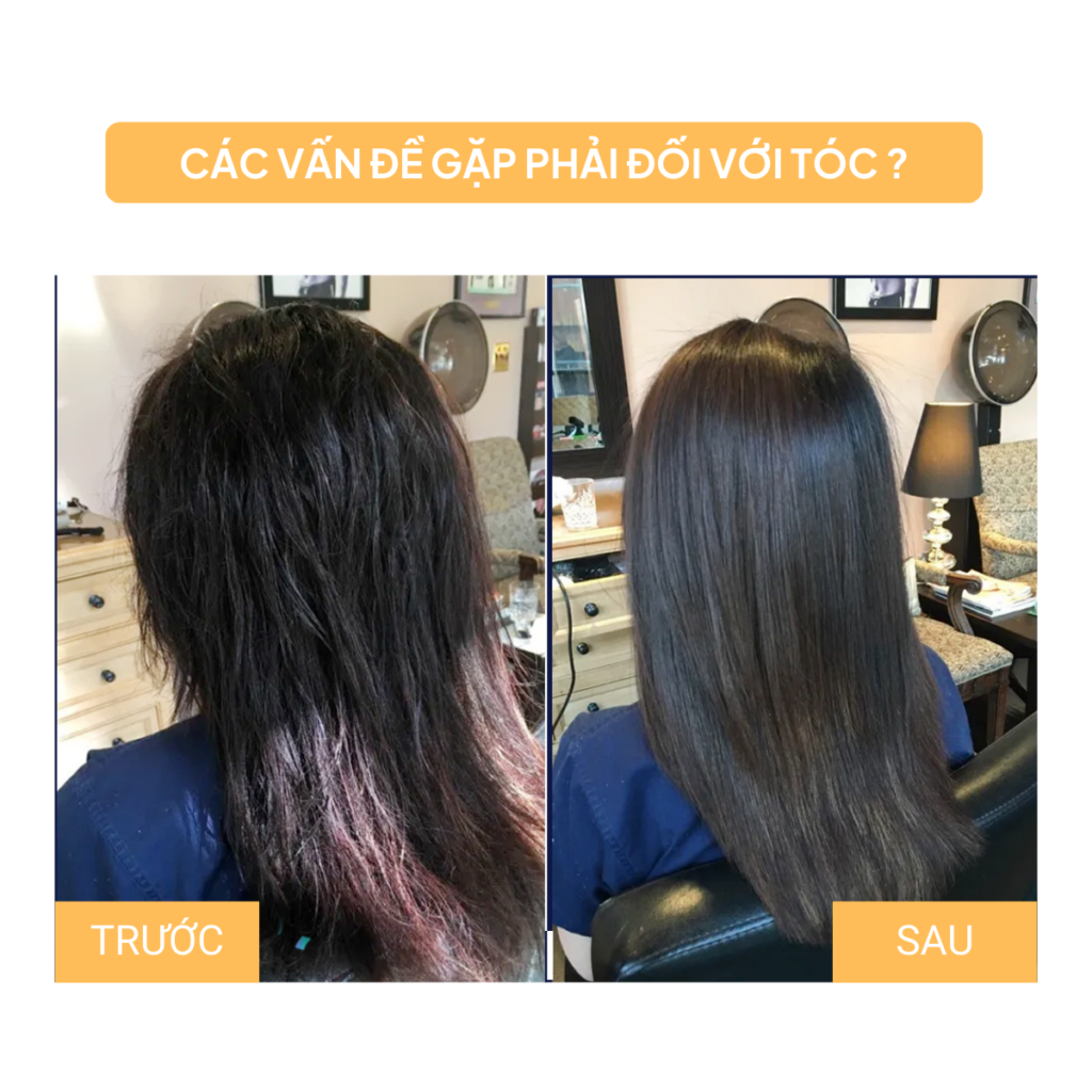 Chuyển giao công nghệ Revskin