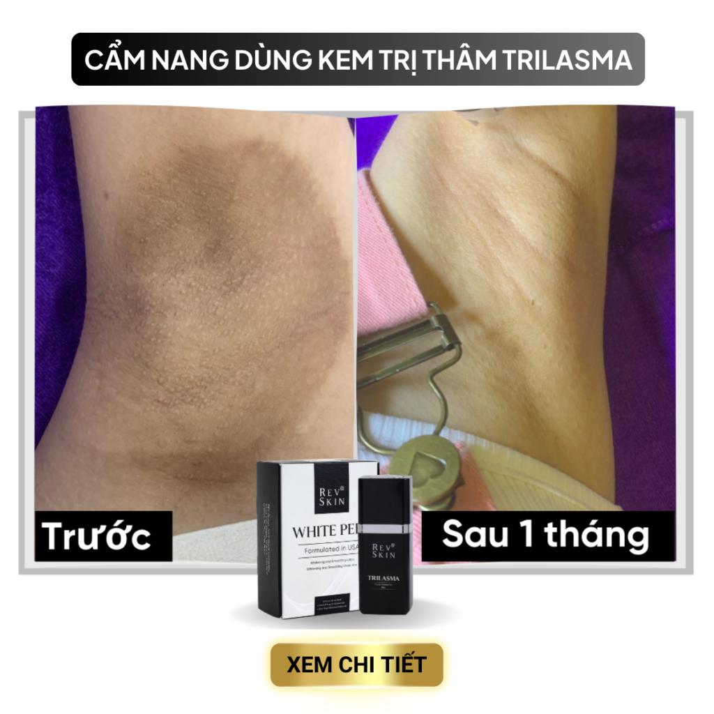 TRỊ THÂM NÁCH TRONG 7 NGÀY CÙNG REVSKIN cac van de trong dieu tri mun 7 2
