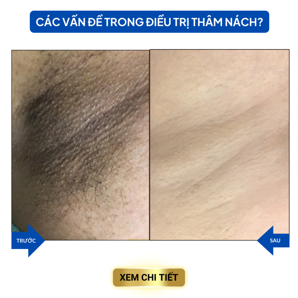 Chuyển giao công nghệ Revskin