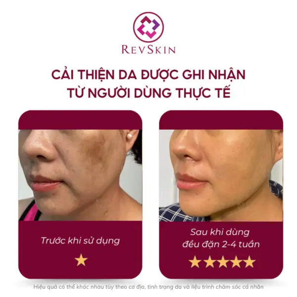 revskin cystamin cream fb1