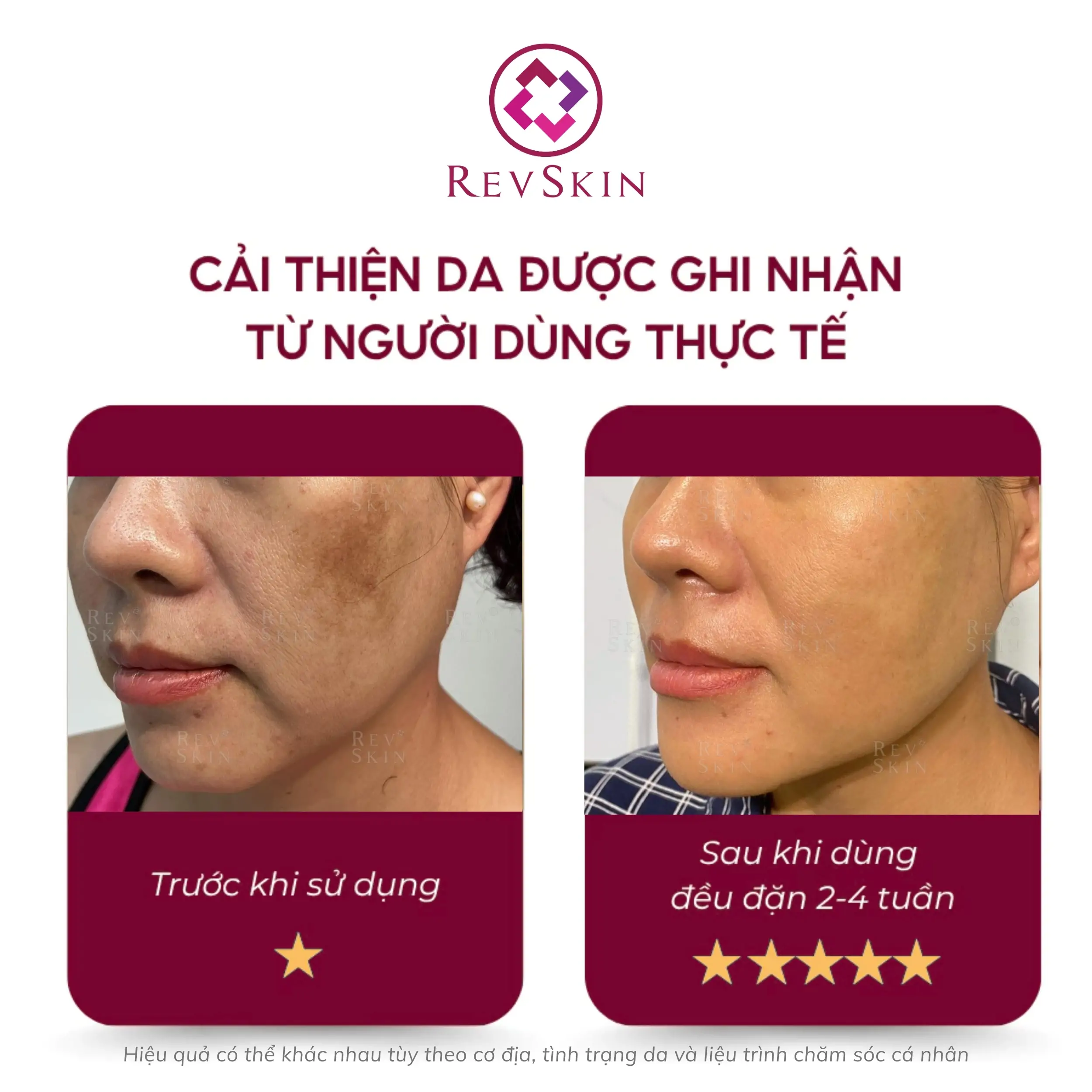 Bộ đôi ức chế sắc tô Cystamin Cream & Cystamin Cleaanser revskin cystamin cream fb1