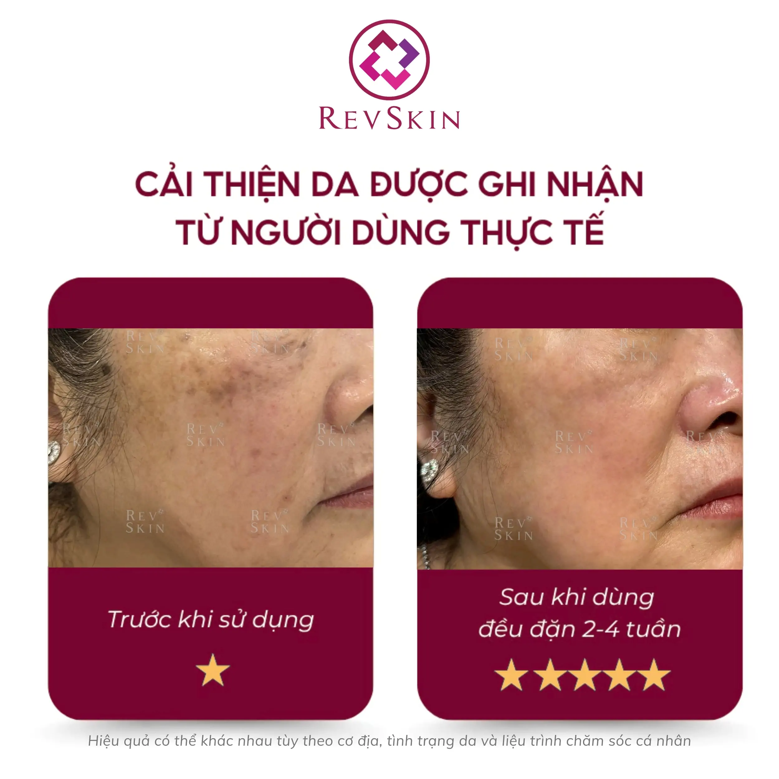Bộ đôi ức chế sắc tô Cystamin Cream & Cystamin Cleaanser revskin cystamin cream fb2