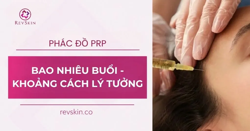 phác đồ prp bao nhiêu buổi