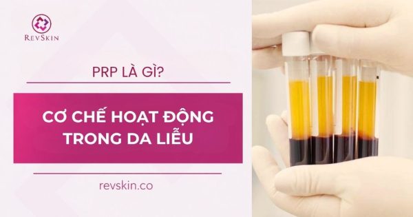 PRP là gì? Cơ chế hoạt động của huyết tương giàu tiểu cầu trong thẩm mỹ prp hoạt động trong thẩm mỹ