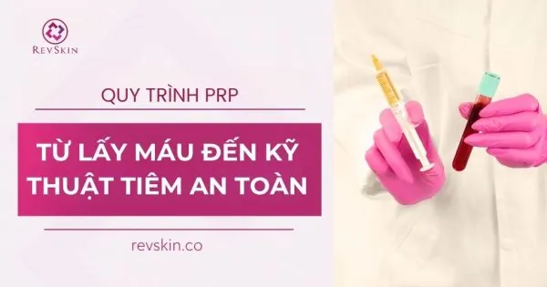 quy trình thực hiện prp an toàn