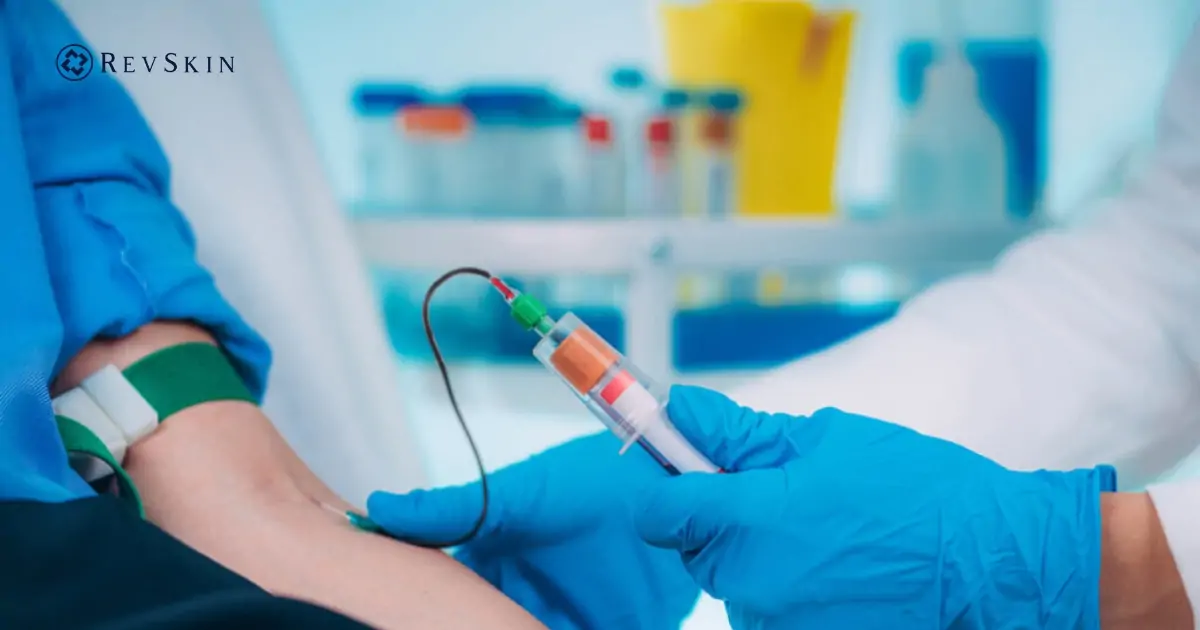 Bước lấy máu trong quy trình PRP