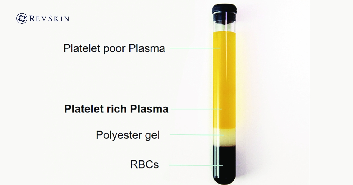 Bước ly tâm tách PRP