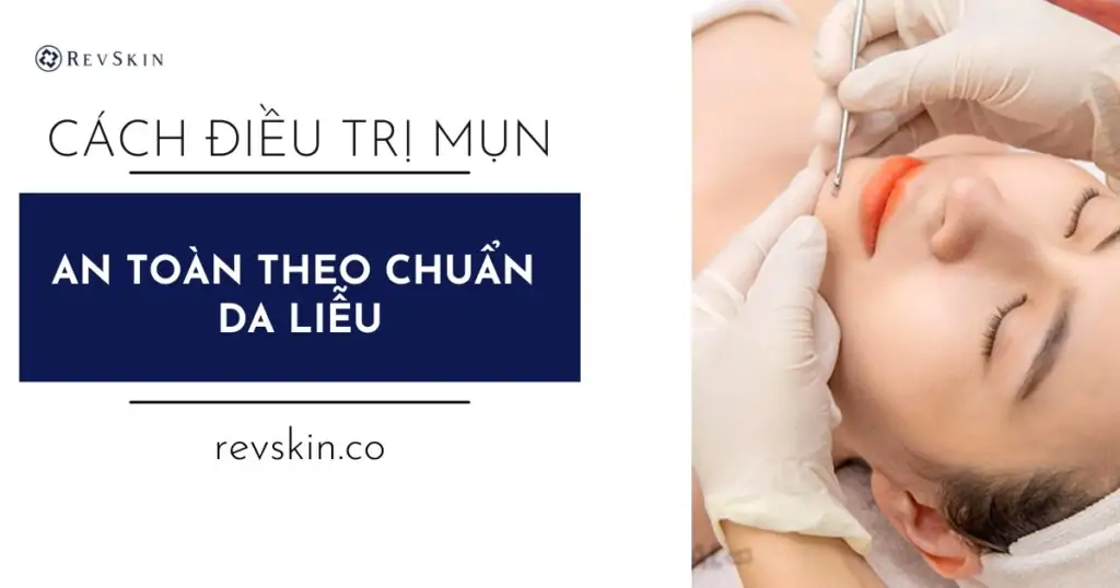 Cách điều trị mụn hiệu quả, an toàn theo chuẩn da liễu Cách điều trị mụn từng trừng hợp