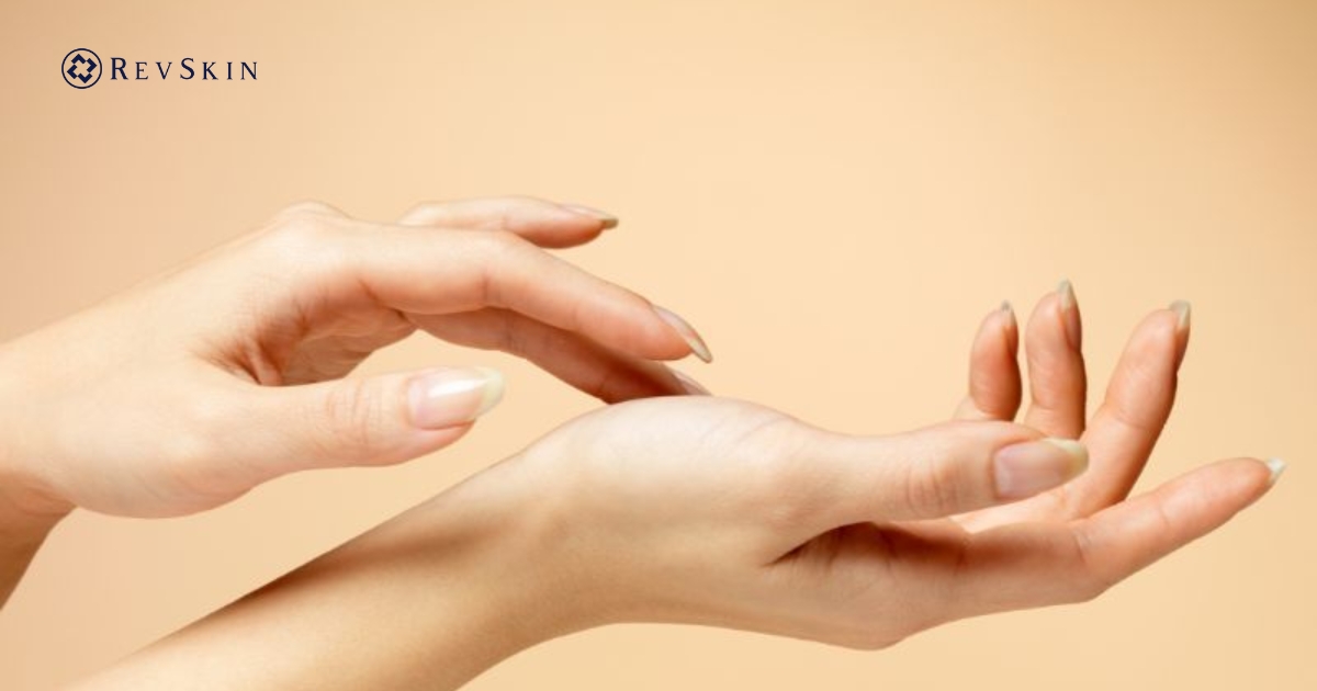 Bị mụn nước ở tay là gì? Nguyên nhân, dấu hiệu và cách xử lý an toàn cho da Cách xử lý mụn nước ở tay
