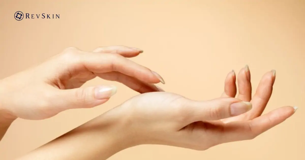 Bị mụn nước ở tay là gì? Nguyên nhân, dấu hiệu và cách xử lý an toàn cho da Cách xử lý mụn nước ở tay