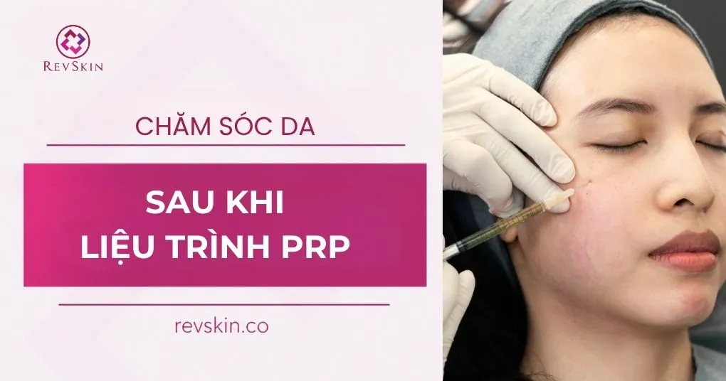 chăm sóc da sau khi tiêm prp