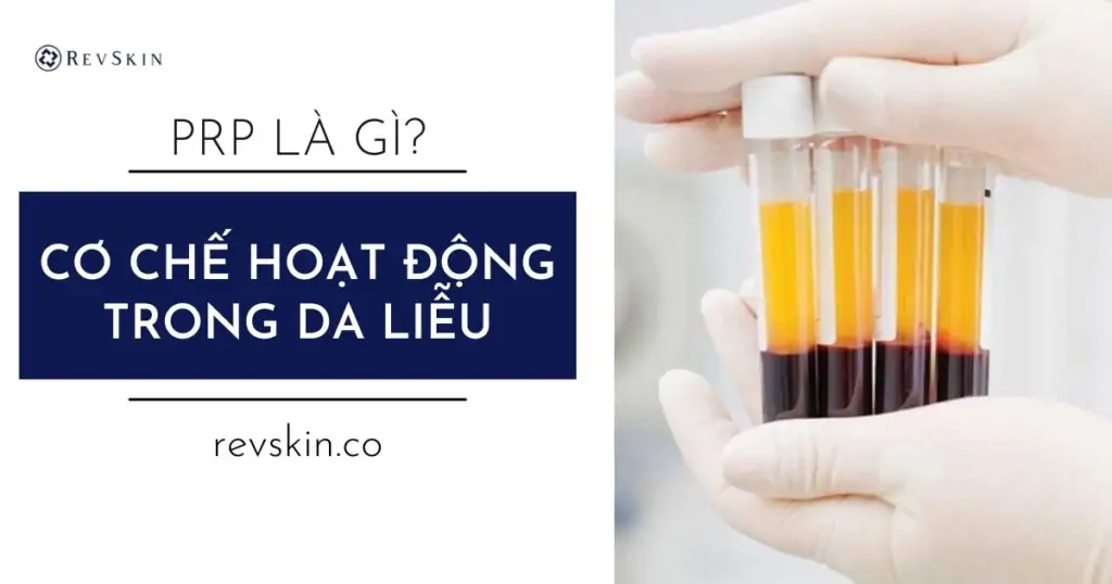 Hoạt động PRP trong da liễu