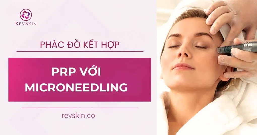 phác đồ kết hợp prp với microneedling