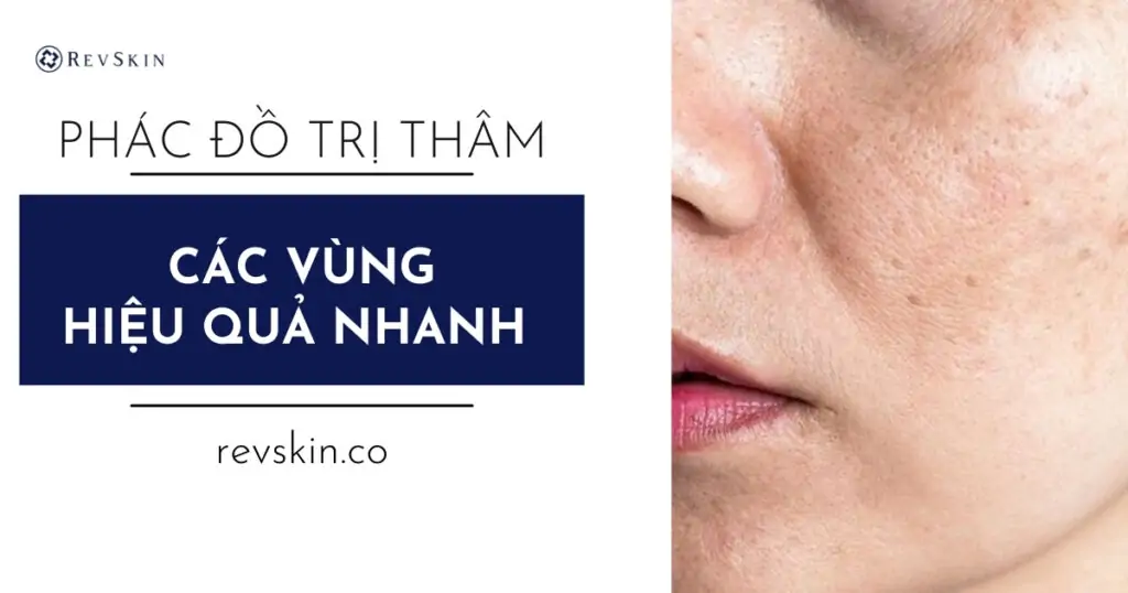 Phác đồ trị thâm các vùng hiệu quả nhanh