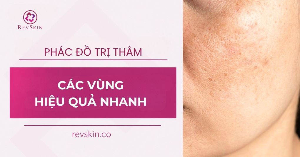 Chuyển giao công nghệ Revskin