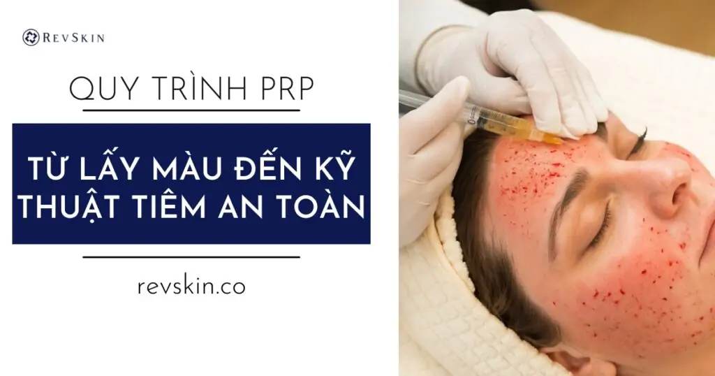 Quy trình thực hiện PRP