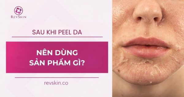 sau peel da nên dùng sản phẩm gì