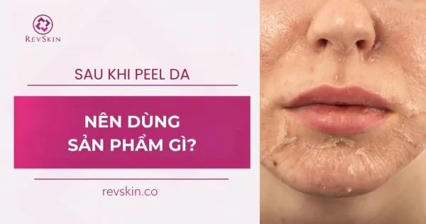 sau peel da nên dùng sản phẩm gì
