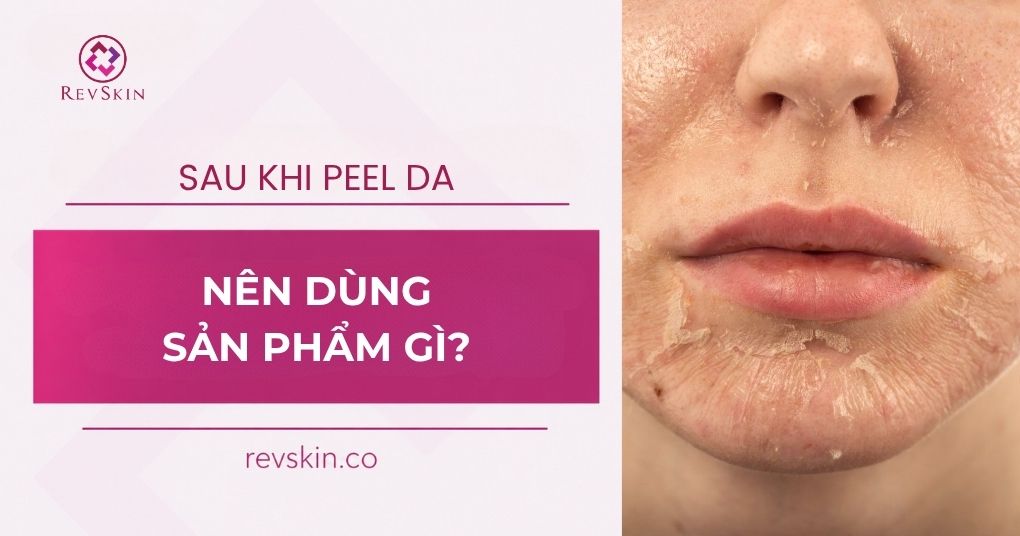 sau peel da nên dùng sản phẩm gì