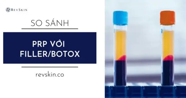 So sánh PRP với Filler