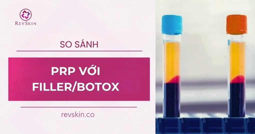 so sánh prp với filler botox