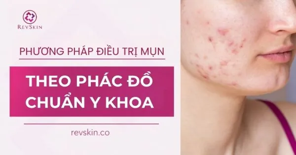 điều trị mụn theo phác đồ chuẩn y khoa